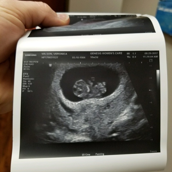 Meet your Posher, Chase - Picture 1 of 1